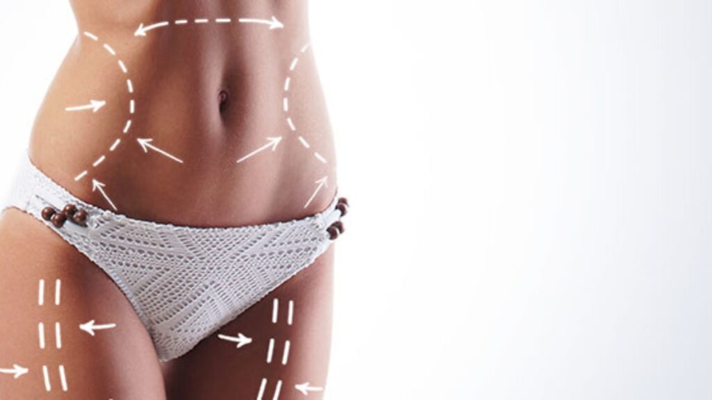 Precisely What Are Certain Advantages Of Vaser Lipo Over Ancient Fat Removal Method?