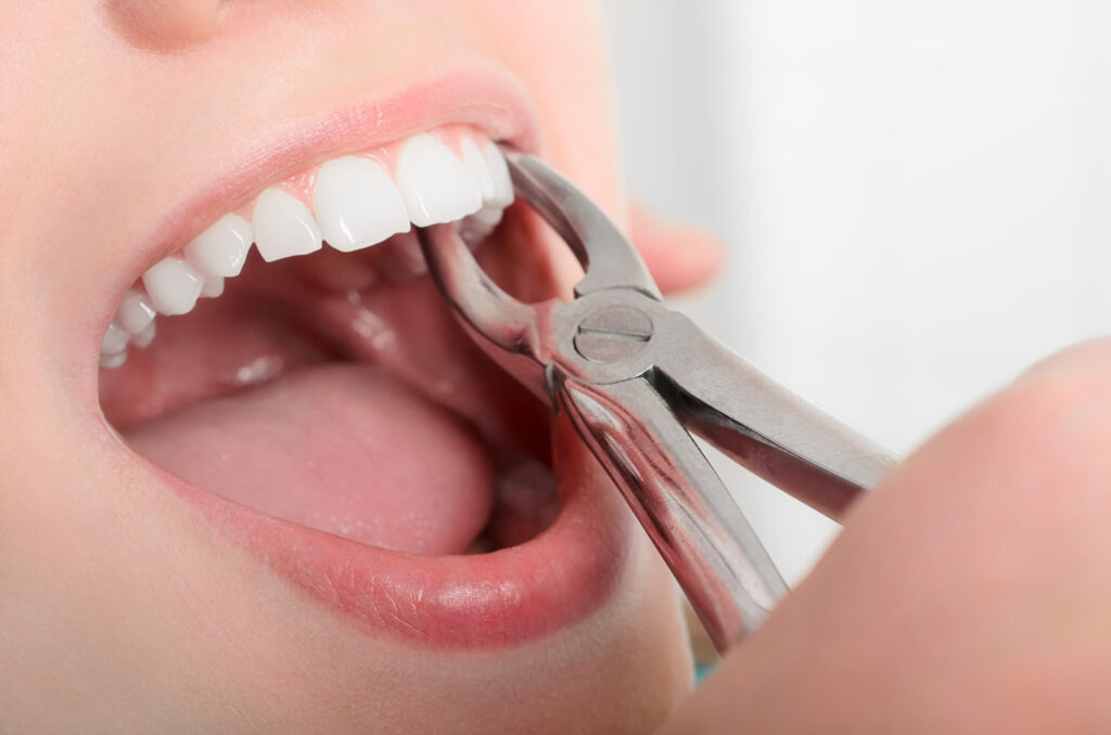 Private Dentistry vs. NHS Care: Navigating Your Smile Options in Edinburgh