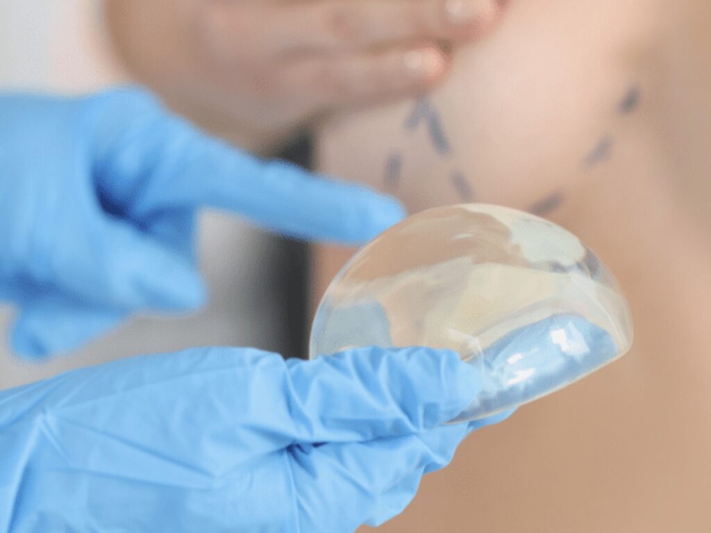 The Science Behind Breast Augmentation: How Modern Techniques Ensure Safe and Natural Results