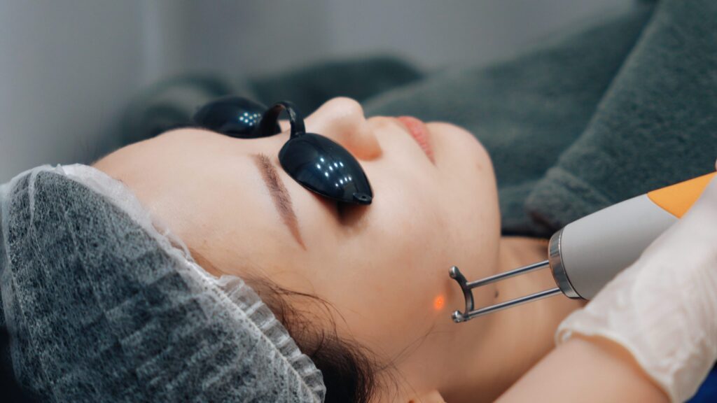 Lightning fast beauty – Quick guide to pico laser treatments
